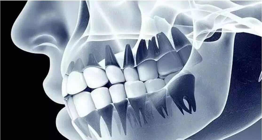 与固定义齿比较，可摘局部义齿的优点及缺点说明