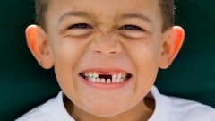 孩子换牙的时候一定要加强护理