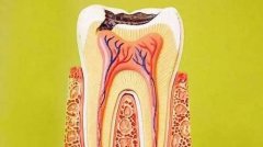 什么是牙髓炎