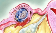 美国试管婴儿4AA的囊胚品级