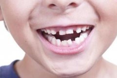 换牙期间孩子牙齿长歪了怎么办?