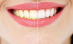 牙齿发黄是什么原因？教你美白牙齿！