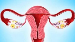 怎样判断是否患有多囊卵巢?