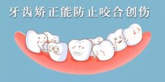 牙齿矫正的过程是什么样的？痛不痛