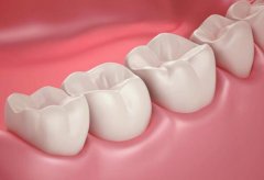 牙齿缺损修复需要多少钱呢