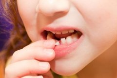 有什么方法预防牙齿松动吗