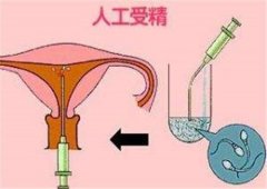 上海公立医院做人工受精前期检查大概多少钱？