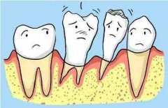 有牙周病能做种植牙吗？为什么牙周病那么麻烦？