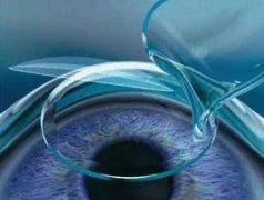 做近视眼手术的术前术后要注意什么？