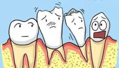 如何护理牙龈萎缩？科普解答