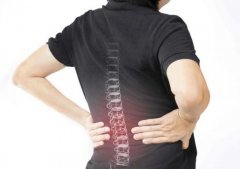 女性常见的腰痛隐患，如何才能及时发现呢？