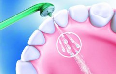 洗牙不会伤害牙齿，为什么洗完牙后会感觉有点酸痛？