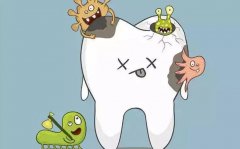 怎样看是不是蛀牙？蛀牙早期症状有哪些表现？