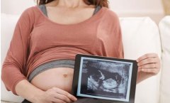 怀孕多少周时是大排畸的检查最佳时间?