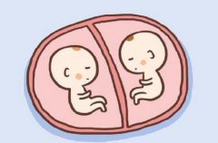 同卵双胞胎有哪些危害？会没有胎心吗？