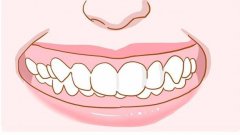 牙齿深覆合到底有多难受?