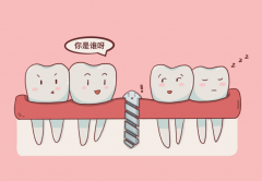 种植牙麻烦吗？种植牙手术要分几次进行？
