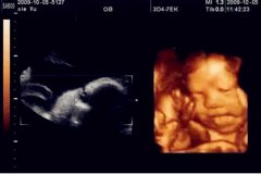 怀孕5个月男女肚型图，怀孕5个月胎儿真实彩超图。