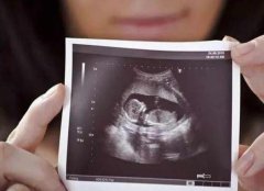孕期四维检查费用大概在300-500元左右-孕妈妈们最重视的检查