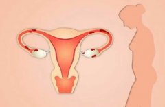输卵管粘连做试管婴儿会引起宫外孕吗？
