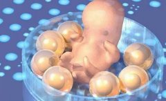 试管婴儿胚胎移植后有哪些不良情况