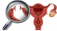 孕七周发现宫外孕是为什么？和妇科炎症有关系吗？